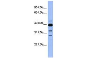 Image no. 1 for anti-Guanine Nucleotide Binding Protein (G Protein), alpha Activating Activity Polypeptide O (GNAO1) (AA 71-120) antibody (ABIN6743833) (GNAO1 anticorps  (AA 71-120))