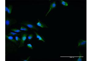 Immunofluorescence of purified MaxPab antibody to SEC13 on HeLa cell.