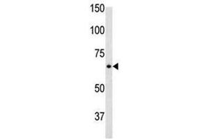 Glial fibrillary acidic protein antibody used in western blot to detect GFAP in mouse brain tissue lysate (GFAP anticorps  (AA 381-410))