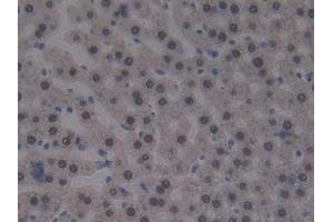 Used in DAB staining on fromalin fixed paraffin- embedded liver tissue