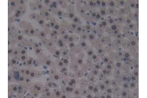 Used in DAB staining on fromalin fixed paraffin- embedded liver tissue (CUBN anticorps  (AA 3511-3623))