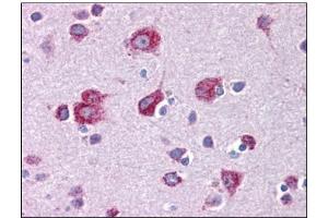 Human Brain, Cortex: Formalin-Fixed, Paraffin-Embedded (FFPE) (MFSD2A anticorps  (C-Term))