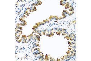 Immunohistochemistry of paraffin-embedded mouse lung using SERPINA10 antibody at dilution of 1:100 (40x lens). (SERPINA10 anticorps)