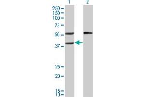 Western Blot analysis of MVK expression in transfected 293T cell line by MVK monoclonal antibody (M02), clone 2C5.