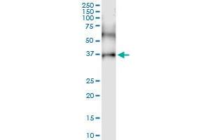 anti-CD200 Receptor 1 (CD200R1) (AA 1-348) antibody