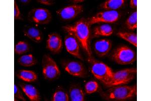 SK-OV-3 cells were fixed with paraformaldehyde, permeabilized with 0.