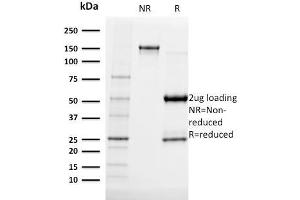 SDS-PAGE Analysis Purified Albumin Mouse Monoclonal Antibody (ALB/2141). (Albumin anticorps)