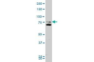 SMO monoclonal antibody (M11), clone 1D9 Western Blot analysis of SMO expression in A-431 . (SMO anticorps  (AA 653-787))
