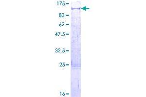 Image no. 1 for TNFAIP3 Interacting Protein 1 (TNIP1) (AA 1-636) protein (GST tag) (ABIN1323260)