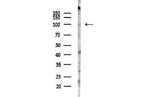 Western blot analysis of lysates from Rat lung, using TRP Antibody at 1/1000 dilution.