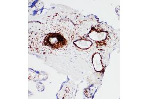 Anti-SERCA1 ATPase antibody, IHC(P) IHC(P): Human Placenta Tissue
