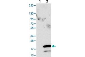 Western blot analysis of Lane 1: Negative control (vector only transfected HEK293T lysate). (SPCS1 anticorps)