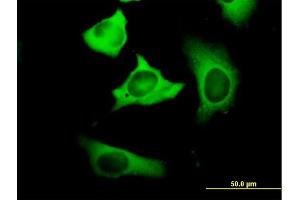 Immunofluorescence of purified MaxPab antibody to FASN on HeLa cell. (Fatty Acid Synthase anticorps  (AA 1-439))