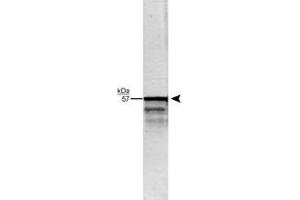 Western blot analysis of Prph in whole rat brain stem homogenate using Prph polyclonal antibody  (1 : 20,000). (Peripherin anticorps)