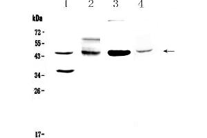 Western blot analysis of CD200/OX2 using anti-CD200/OX2 antibody . (CD200 anticorps  (AA 31-231))
