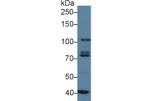 Western blot analysis of Human K562 cell lysate, using Human STAT2 Antibody (3 µg/ml) and HRP-conjugated Goat Anti-Rabbit antibody ( (STAT2 anticorps  (AA 616-849))