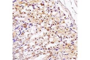 Immunohistochemistry of paraffin embedded mouse stomach using MECOM (ABIN7074575) at dilution of 1: 2200 (400x lens)