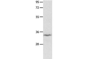 Western Blot analysis of Mouse brain tissue using IGFBP7 Polyclonal Antibody at dilution of 1:400 (IGFBP7 anticorps)