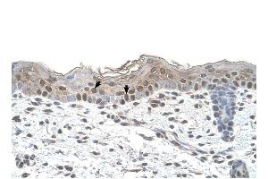 Arrestin B2 antibody was used for immunohistochemistry at a concentration of 4-8 ug/ml to stain Squamous epithelial cells (arrows) in Human Skin.