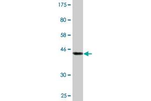 Western Blot detection against Immunogen (45.