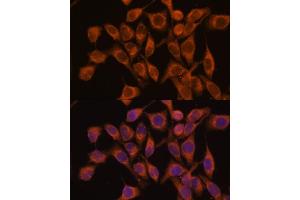 Immunofluorescence analysis of HeLa cells using UBQLNL antibody (ABIN7271125) at dilution of 1:100. (UBQLNL anticorps  (AA 176-475))