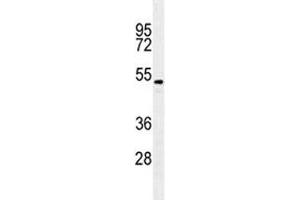 TGFB2 antibody western blot analysis in A549 lysate. (TGFB2 anticorps)