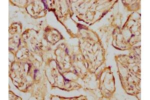 IHC image of ABIN7127445 diluted at 1:230 and staining in paraffin-embedded human placenta tissue performed on a Leica BondTM system. (Recombinant Aromatase anticorps)