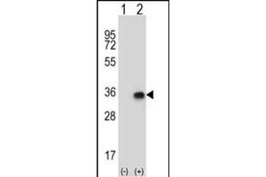 Western blot analysis of CNOT8 (arrow) using rabbit polyclonal CNOT8 Antibody (N-term) (ABIN656816 and ABIN2846030). (CNOT8 anticorps  (N-Term))