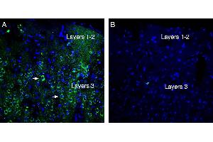 Expression of Neogenin in rat parietal cortex. (NEO1 anticorps  (Extracellular))