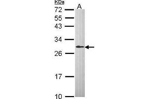 WB Image Sample (30 ug of whole cell lysate) A: Hep G2 , 12% SDS PAGE antibody diluted at 1:1000 (DCXR anticorps  (C-Term))