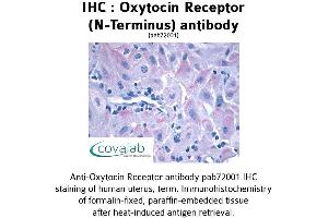 Image no. 1 for anti-Oxytocin Receptor (OXTR) (Extracellular Domain), (N-Term) antibody (ABIN1737739) (Oxytocin Receptor anticorps  (Extracellular Domain, N-Term))