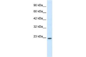 WB Suggested Anti-HOXB6 Antibody Titration: 0. (HOXB6 anticorps  (N-Term))
