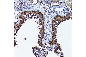 Immunohistochemistry of paraffin-embedded rat lung using SEC14L2 Rabbit pAb (ABIN6132639, ABIN6147484, ABIN6147485 and ABIN6214889) at dilution of 1:200 (40x lens).