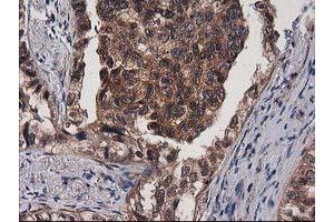 Image no. 9 for anti-Destrin (Actin Depolymerizing Factor) (DSTN) antibody (ABIN1497908)