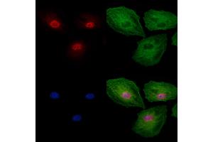Phospho-Gli2 (Ser149) Antibody staining A549 cells(4h of LPS treatment) by IF/ICC. (GLI2 anticorps  (pSer149))