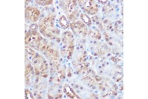 Immunohistochemistry of paraffin-embedded mouse kidney using ERK5 Rabbit mAb (ABIN1680723, ABIN3018327, ABIN3018328 and ABIN7101595) at dilution of 1:100 (40x lens). (MAPK7 anticorps)