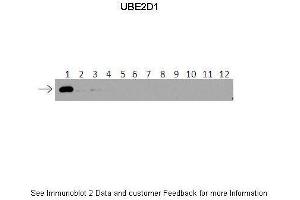 Lanes:   1: 40ng HIS-UBE2D1 protein 2: 40ng HIS-UBE2D2 protein 3: 40ng HIS-UBE2D3 protein 4: 40ng HIS-UBE2D4 protein 5: 40ng HIS-UBE2E1 protein 6: 40ng HIS-UBE2E2 protein 7: 40ng HIS-UBE2E3 protein 8: 40ng HIS-UBE2K protein 9: 40ng HIS-UBE2L3 protein 10: 40ng HIS-UBE2N protein 11: 40ng HIS-UBE2V1 protein 12: 40ng HIS-UBE2V2 protein.
