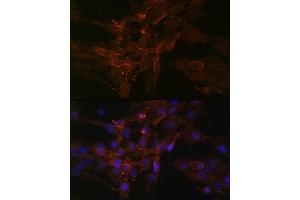 Immunofluorescence analysis of C6 cells using Na+/K+-ATPase Rabbit mAb (ABIN7270390) at dilution of 1:100 (40x lens).