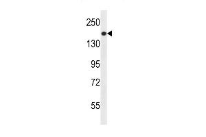 PREX1 Antibody (C-term) (ABIN656506 and ABIN2845778) western blot analysis in NCI- cell line lysates (35 μg/lane).