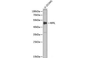 Western blot analysis of extracts of U-251MG cells using RFFL Polyclonal Antibody at dilution of 1:1000. (RFFL anticorps)