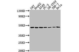 Western Blot Positive WB detected in: U87 whole cell lysate, HepG2 whole cell lysate, A549 whole cell lysate, PC-3 whole cell lysate, SH-SY5Y whole cell lysate, THP-1 whole cell lysate, Hela whole cell lysate All lanes: NDRG1 antibody at 1:2000 Secondary Goat polyclonal to rabbit IgG at 1/50000 dilution Predicted band size: 43, 36, 34 kDa Observed band size: 43 kDa (NDRG1 anticorps  (AA 136-394))