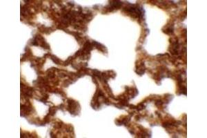 Immunohistochemical analysis of NETO1 in rat lung tissue with NETO1 polyclonal antibody  at 2. (NETO1 anticorps  (C-Term))