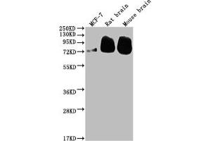 Western Blot Positive WB detected in: MCF-7 whole cell lysate, Rat brain tissue, Mouse brain tissue All lanes: BACE1 antibody at 1:2000 Secondary Goat polyclonal to rabbit IgG at 1/50000 dilution Predicted band size: 56, 53, 52, 49, 46, 43 kDa Observed band size: 72 kDa (Recombinant BACE1 anticorps)