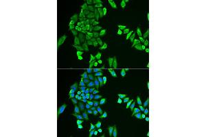 Immunofluorescence analysis of HeLa cell using ACSS2 antibody. (ACSS2 anticorps)