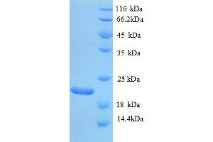 SDS-PAGE (SDS) image for Plasminogen Activator, Urokinase (PLAU) (AA 21-173) protein (His tag) (ABIN5712906)