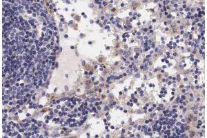 ABIN6267279 at 1/200 staining human lymph node tissue sections by IHC-P.