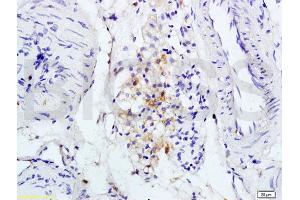 L1 rat brain lysates L2 rat kidney lysates probed with Anti IL-1R1/CD121a/IL1 Receptor I Polyclonal Antibody, Unconjugated (ABIN747743) at 1:200 overnight at 4 °C.