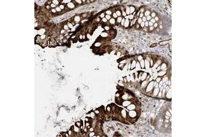 Immunohistochemical staining of human colon with BCORL1 polyclonal antibody  shows strong cytoplasmic and membranous positivity in glandular cells.