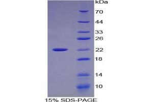 SDS-PAGE analysis of Cow Matrix Metalloproteinase 9 (MMP9) Protein. (MMP 9 Protéine)