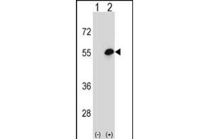 Western blot analysis of COCH (arrow) using rabbit polyclonal COCH Antibody (Center) (ABIN656833 and ABIN2846042). (COCH anticorps  (AA 399-428))